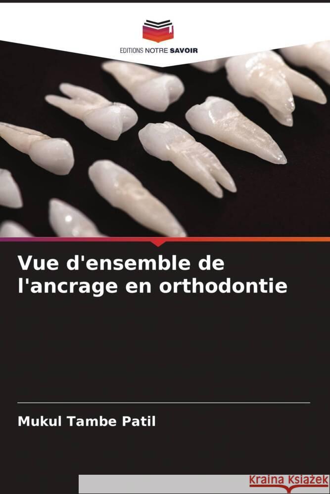 Vue d'ensemble de l'ancrage en orthodontie Tambe Patil, Mukul 9786206497455