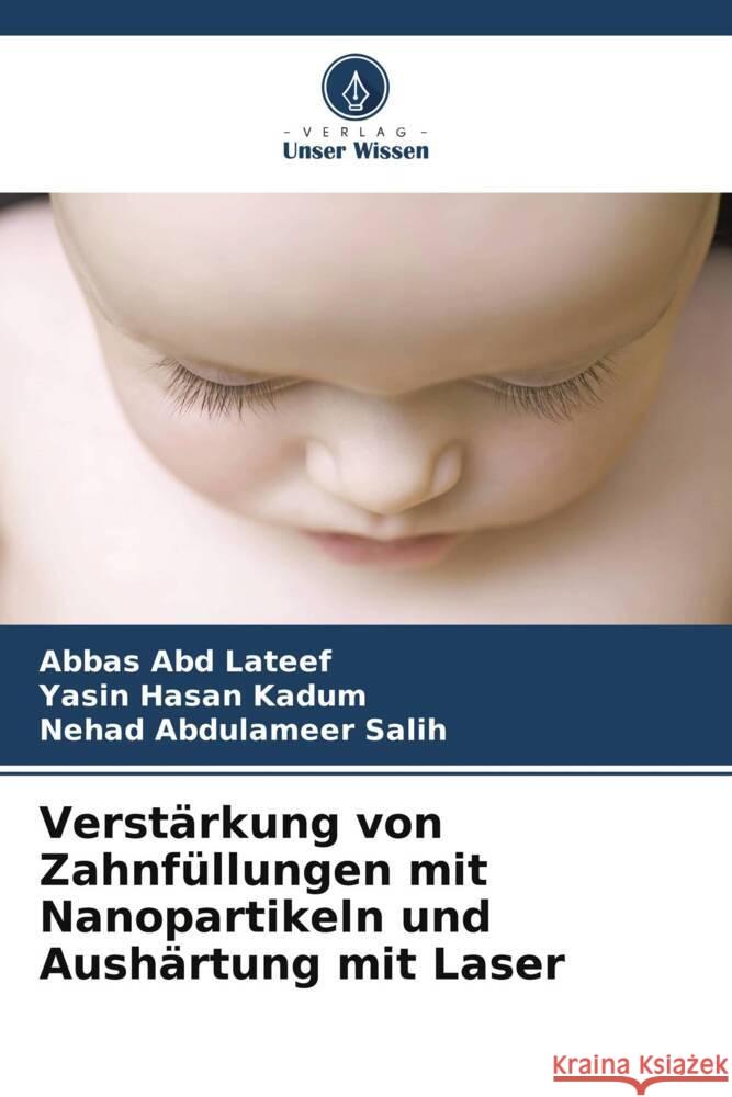 Verstärkung von Zahnfüllungen mit Nanopartikeln und Aushärtung mit Laser Abd Lateef, Abbas, Hasan Kadum, Yasin, Abdulameer Salih, Nehad 9786206504894 Verlag Unser Wissen