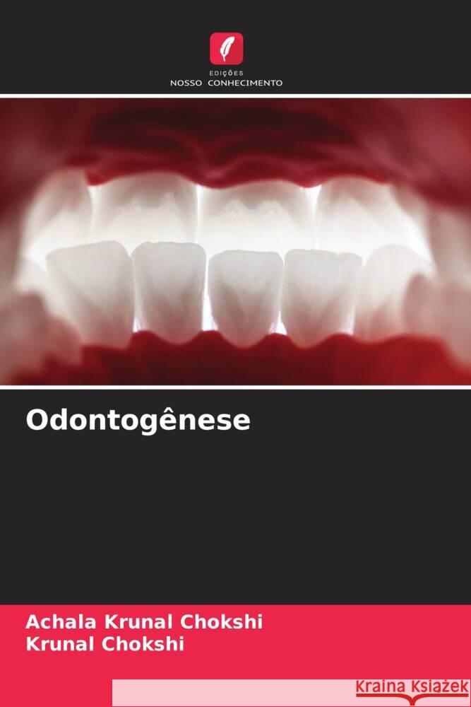 Odontog?nese Achala Krunal Chokshi Krunal Chokshi 9786206519546