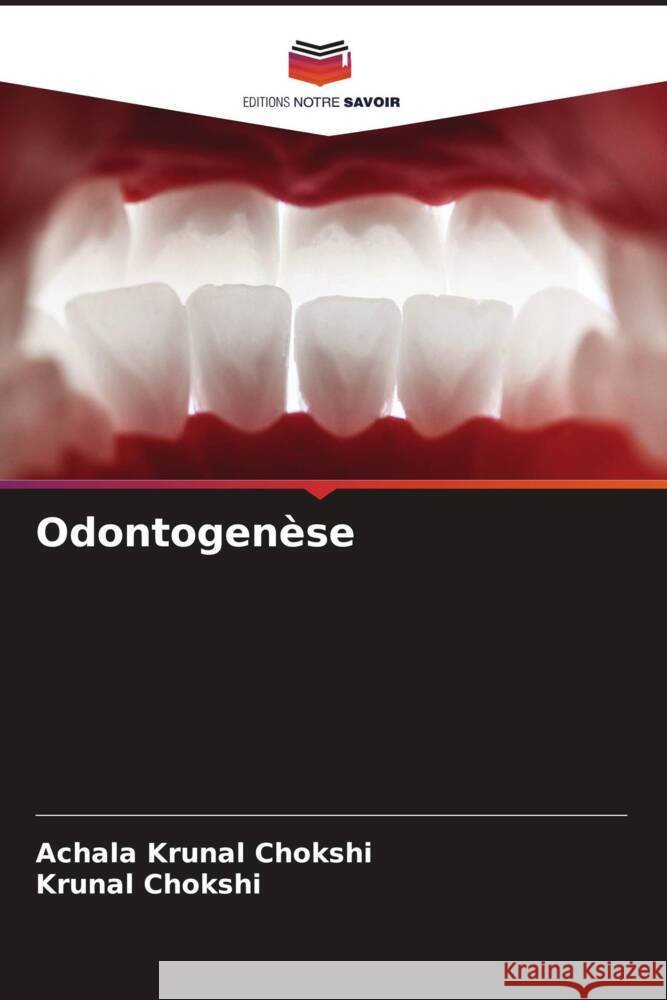 Odontogenèse CHOKSHI, ACHALA KRUNAL, Chokshi, Krunal 9786206519577
