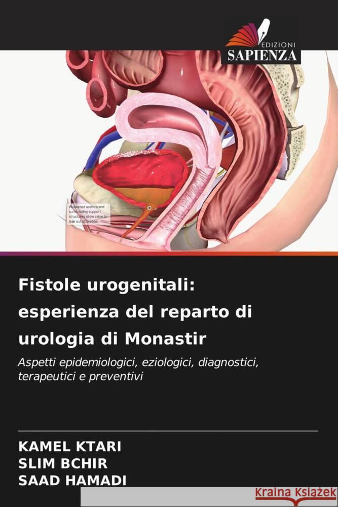 Fistole urogenitali: esperienza del reparto di urologia di Monastir Ktari, Kamel, BCHIR, SLIM, HAMADI, SAAD 9786206521150