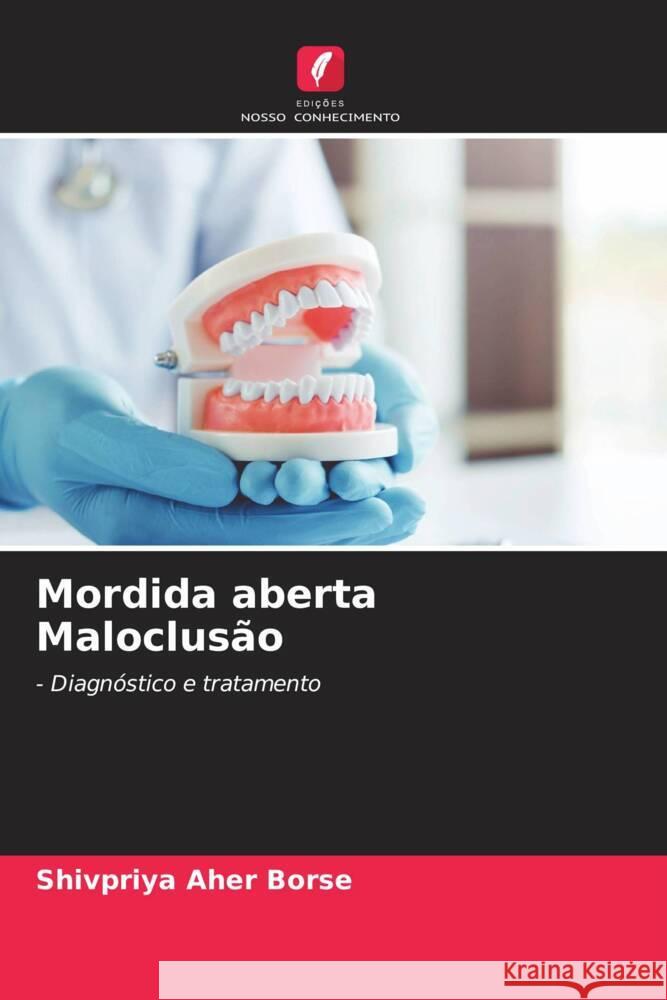 Mordida aberta Maloclusão Aher Borse, Shivpriya 9786206534563