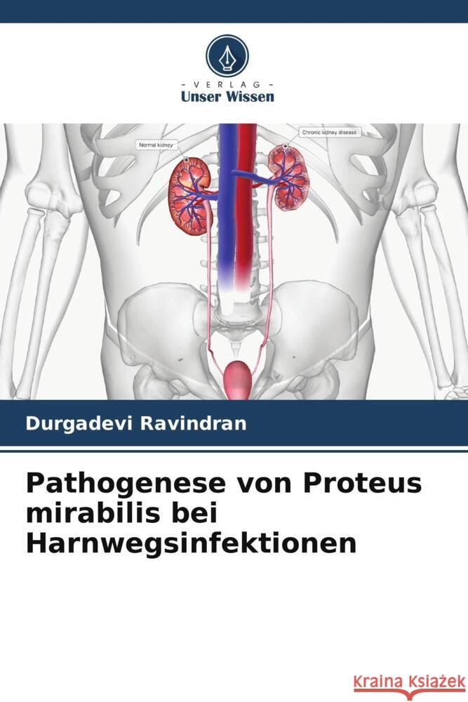 Pathogenese von Proteus mirabilis bei Harnwegsinfektionen Ravindran, Durgadevi 9786206536246