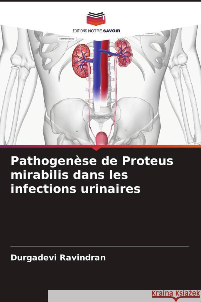 Pathogenèse de Proteus mirabilis dans les infections urinaires Ravindran, Durgadevi 9786206536253