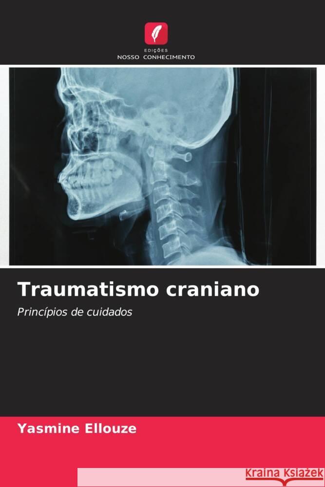 Traumatismo craniano Ellouze, Yasmine 9786206541431