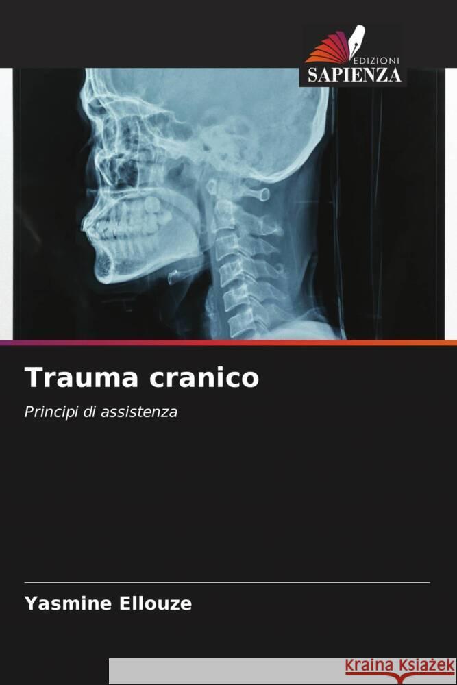 Trauma cranico Ellouze, Yasmine 9786206541554