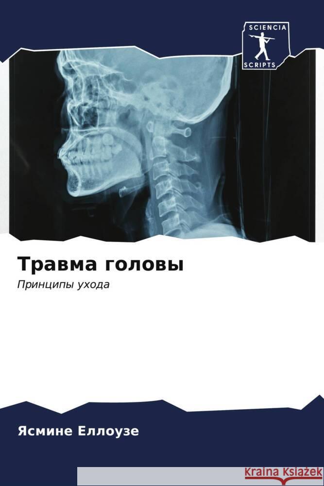 Trawma golowy Ellouze, Yasmine 9786206541561