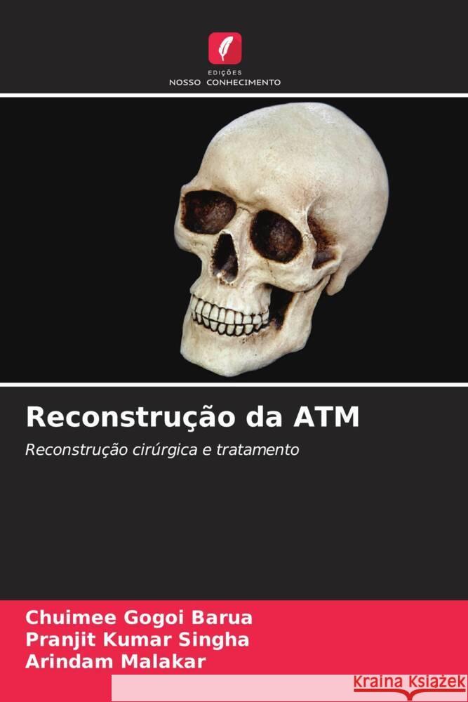 Reconstrução da ATM Barua, Chuimee Gogoi, Singha, Pranjit Kumar, Malakar, Arindam 9786206545309 Edições Nosso Conhecimento