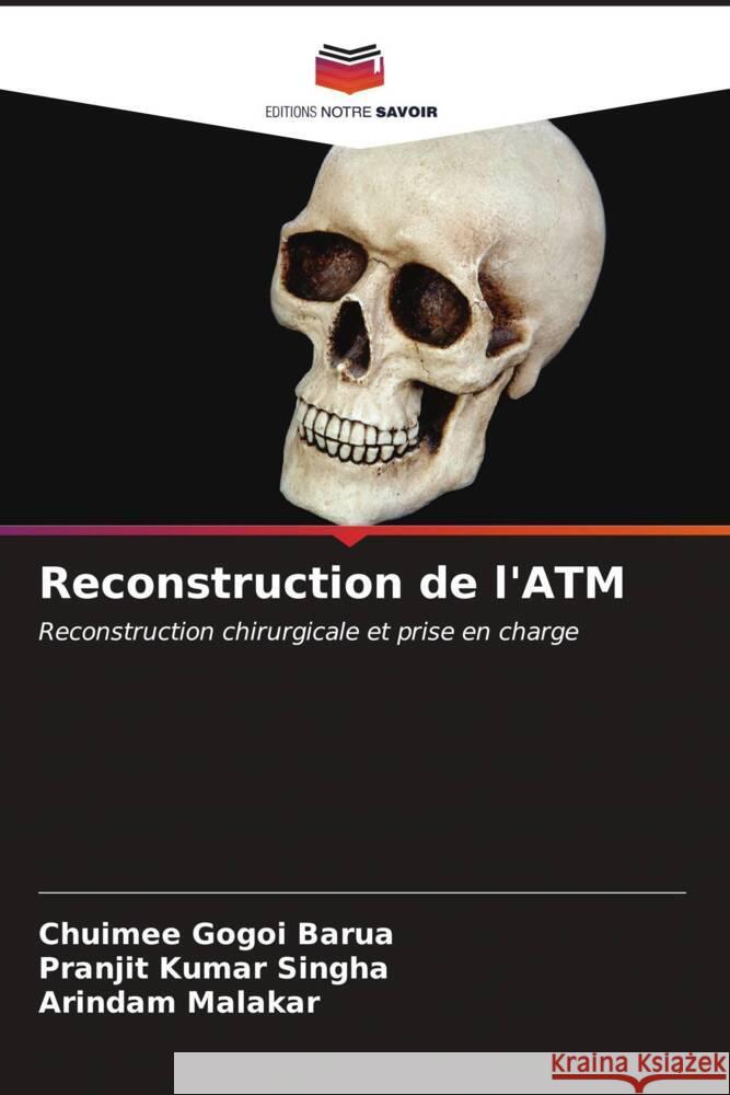 Reconstruction de l'ATM Barua, Chuimee Gogoi, Singha, Pranjit Kumar, Malakar, Arindam 9786206545330 Editions Notre Savoir