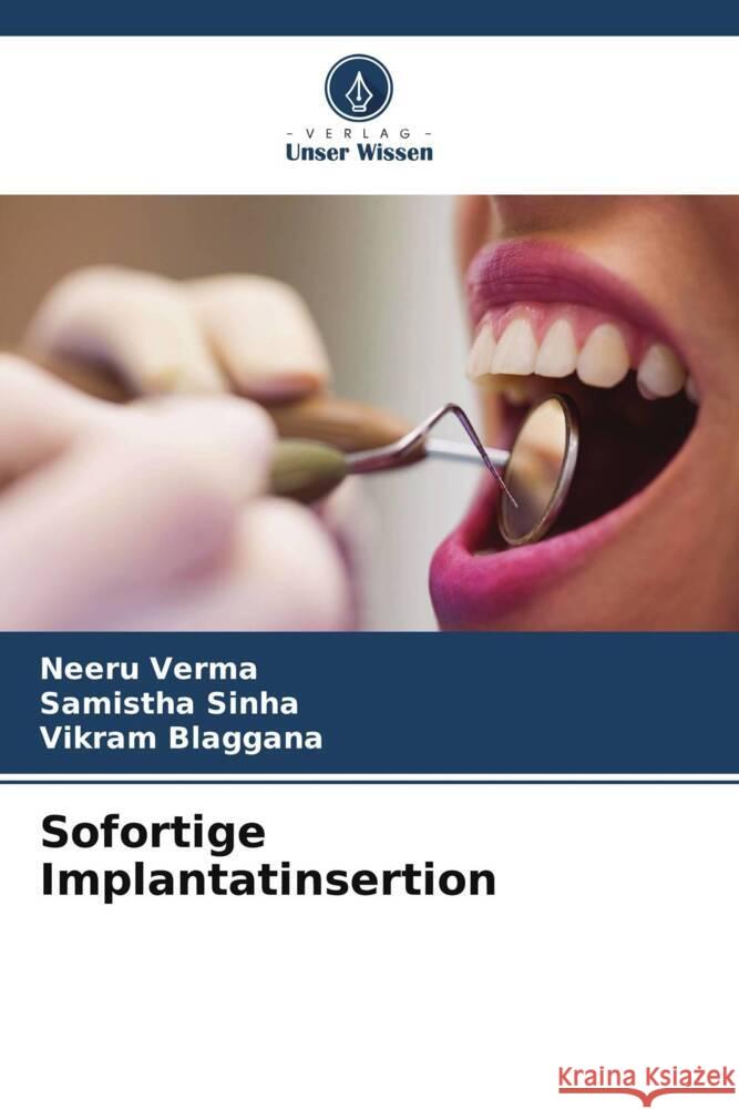 Sofortige Implantatinsertion Neeru Verma Samistha Sinha Vikram Blaggana 9786206546566