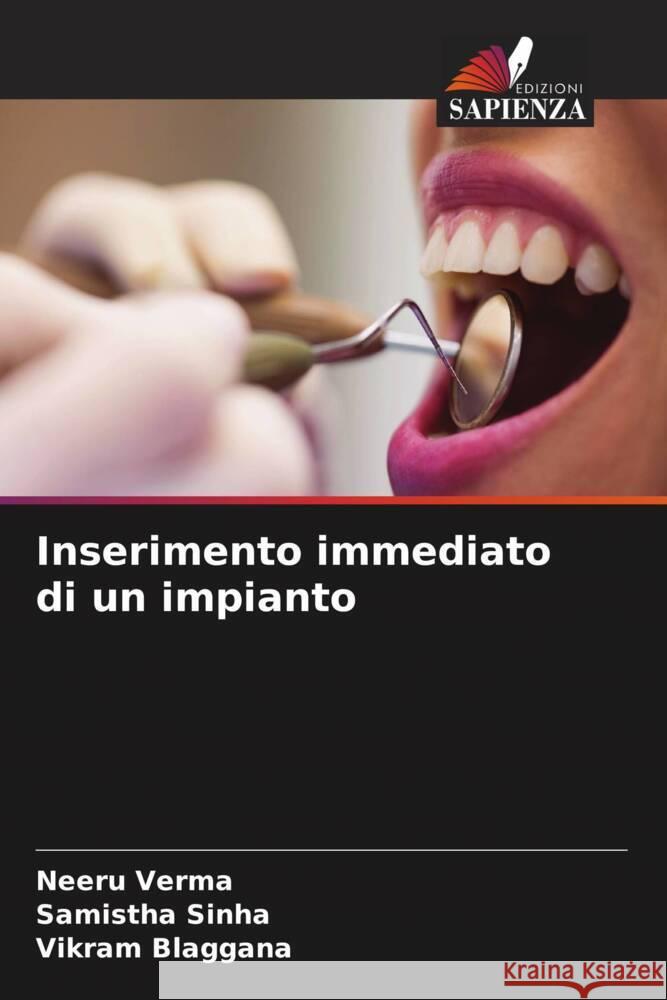 Inserimento immediato di un impianto Neeru Verma Samistha Sinha Vikram Blaggana 9786206546603