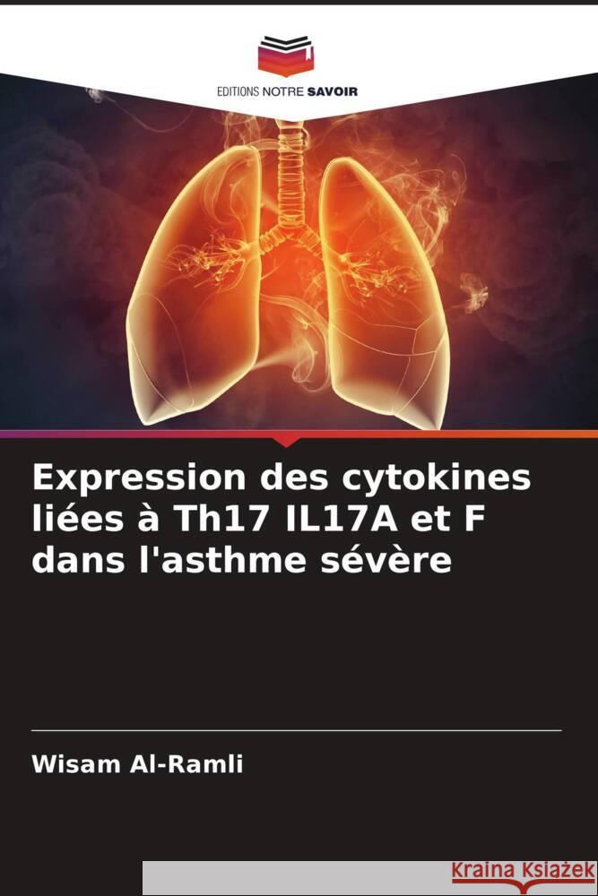 Expression des cytokines liées à Th17 IL17A et F dans l'asthme sévère Al-Ramli, Wisam 9786206547976