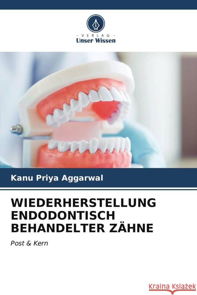 WIEDERHERSTELLUNG ENDODONTISCH BEHANDELTER ZÄHNE Aggarwal, Kanu Priya 9786206563662