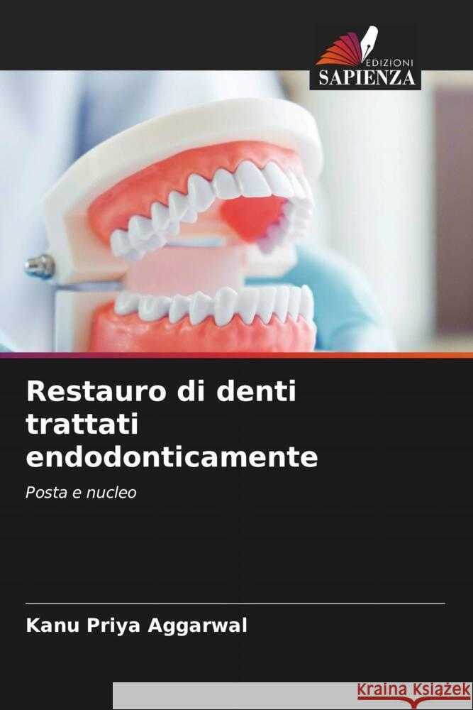 Restauro di denti trattati endodonticamente Aggarwal, Kanu Priya 9786206563693