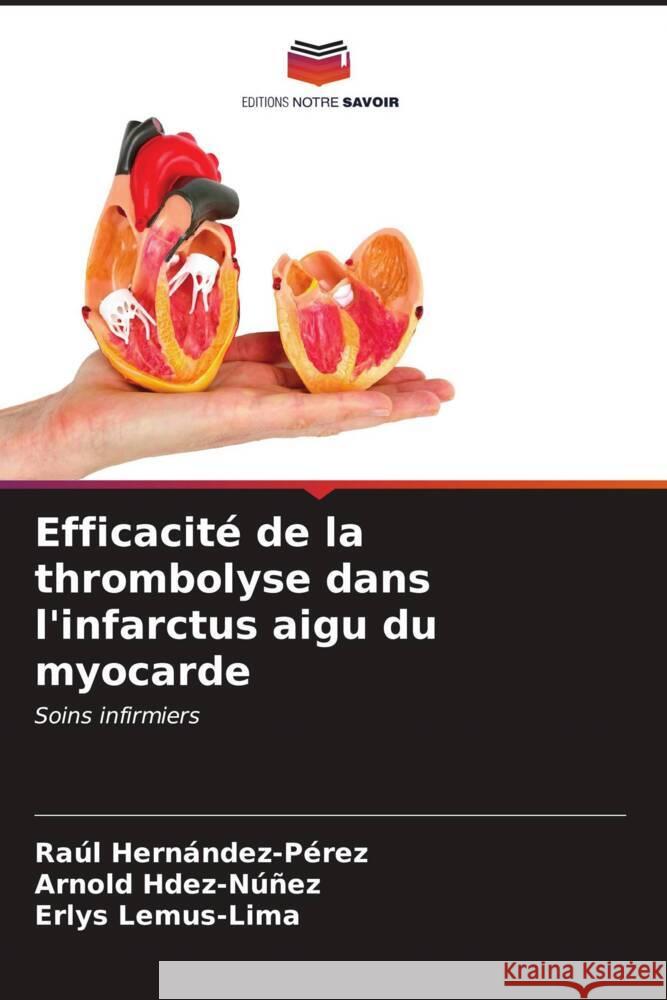 Efficacité de la thrombolyse dans l'infarctus aigu du myocarde Hernández-Pérez, Raúl, Hdez-Núñez, Arnold, Lemus-Lima, Erlys 9786206567349