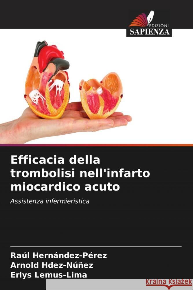 Efficacia della trombolisi nell'infarto miocardico acuto Hernández-Pérez, Raúl, Hdez-Núñez, Arnold, Lemus-Lima, Erlys 9786206567363