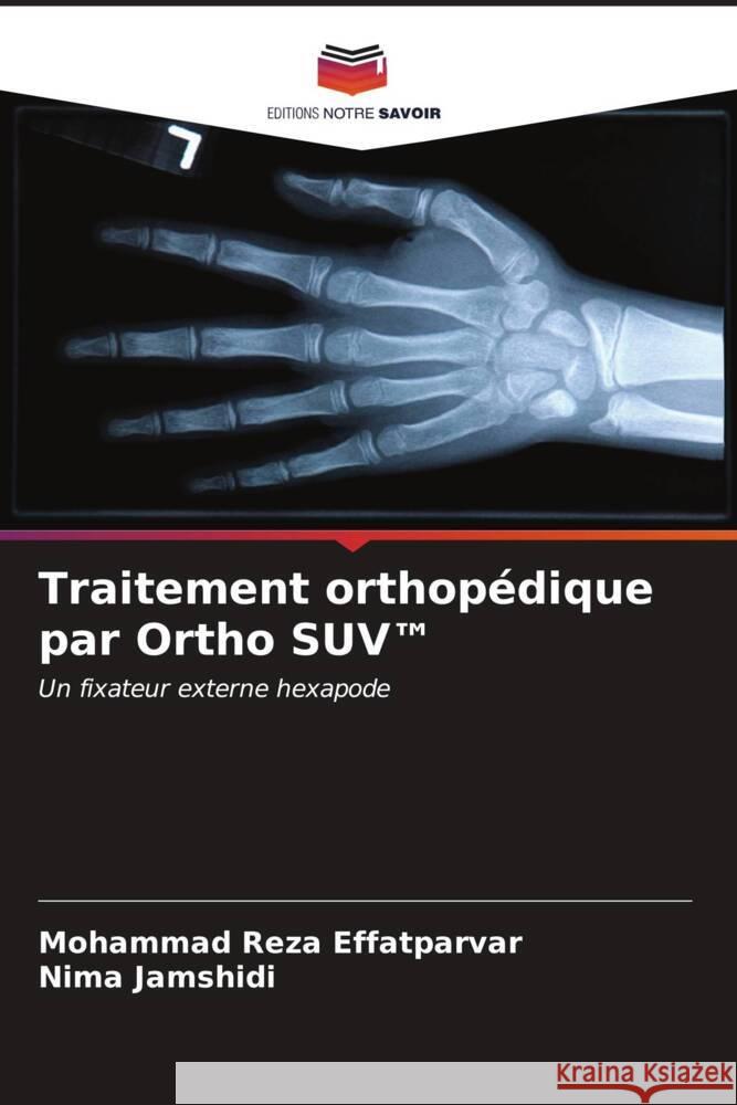 Traitement orthopédique par Ortho SUV(TM) Effatparvar, Mohammad Reza, Jamshidi, Nima 9786206569435