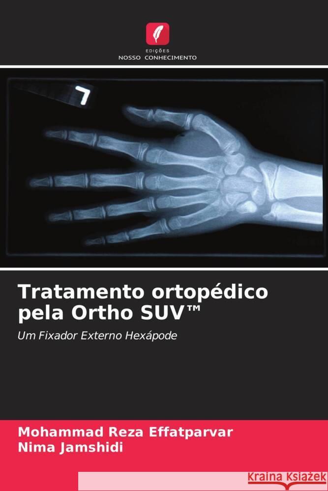 Tratamento ortopédico pela Ortho SUV(TM) Effatparvar, Mohammad Reza, Jamshidi, Nima 9786206569459