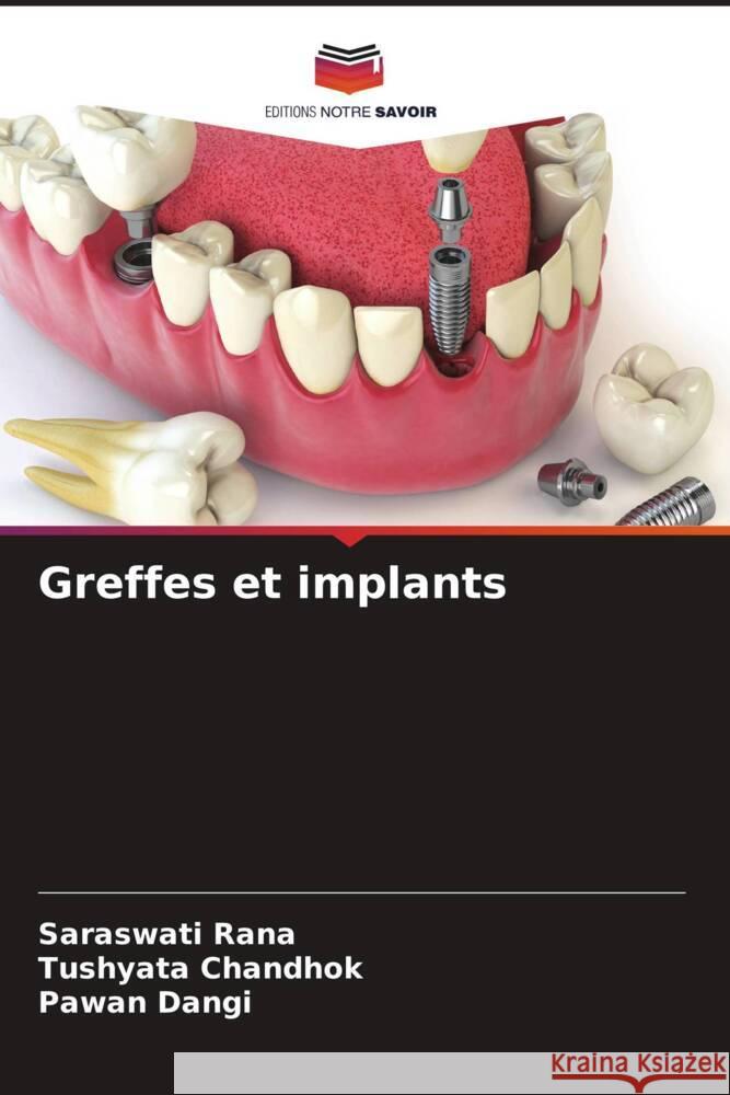 Greffes et implants Rana, Saraswati, Chandhok, Tushyata, Dangi, Pawan 9786206575085