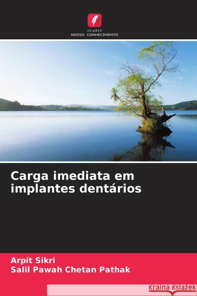 Carga imediata em implantes dent?rios Arpit Sikri Salil Pawah Cheta 9786206586029 Edicoes Nosso Conhecimento