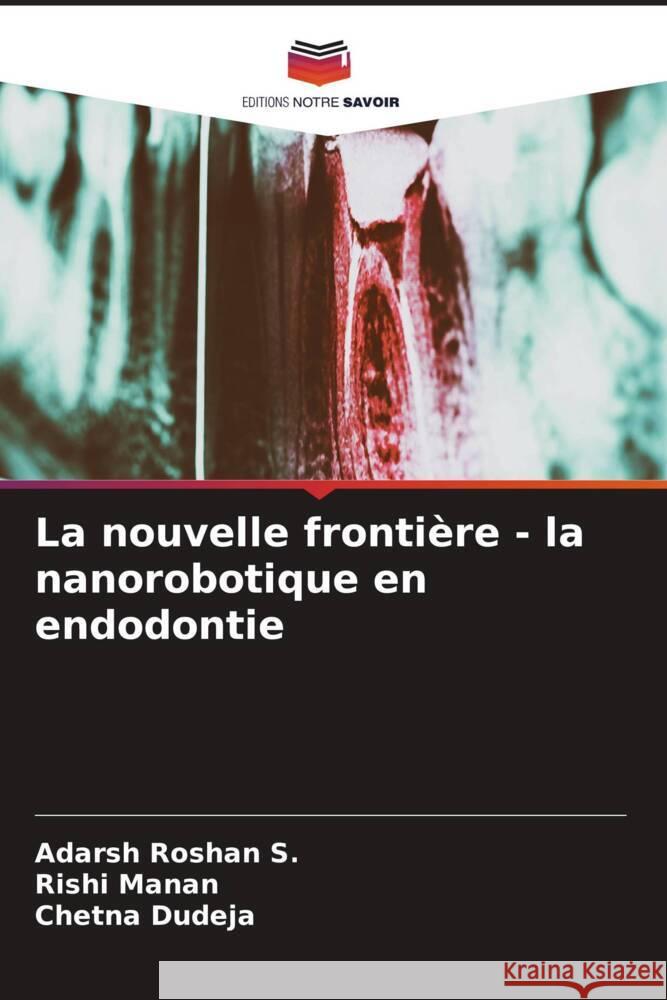 La nouvelle frontière - la nanorobotique en endodontie Roshan S., Adarsh, Manan, Rishi, Dudeja, Chetna 9786206587378