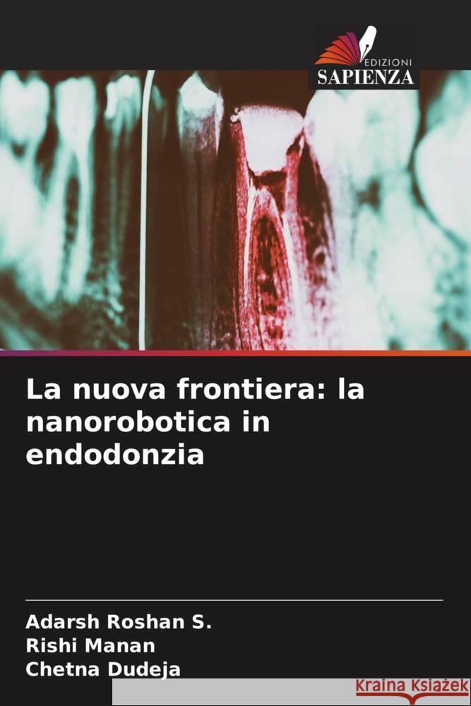 La nuova frontiera: la nanorobotica in endodonzia Roshan S., Adarsh, Manan, Rishi, Dudeja, Chetna 9786206588139