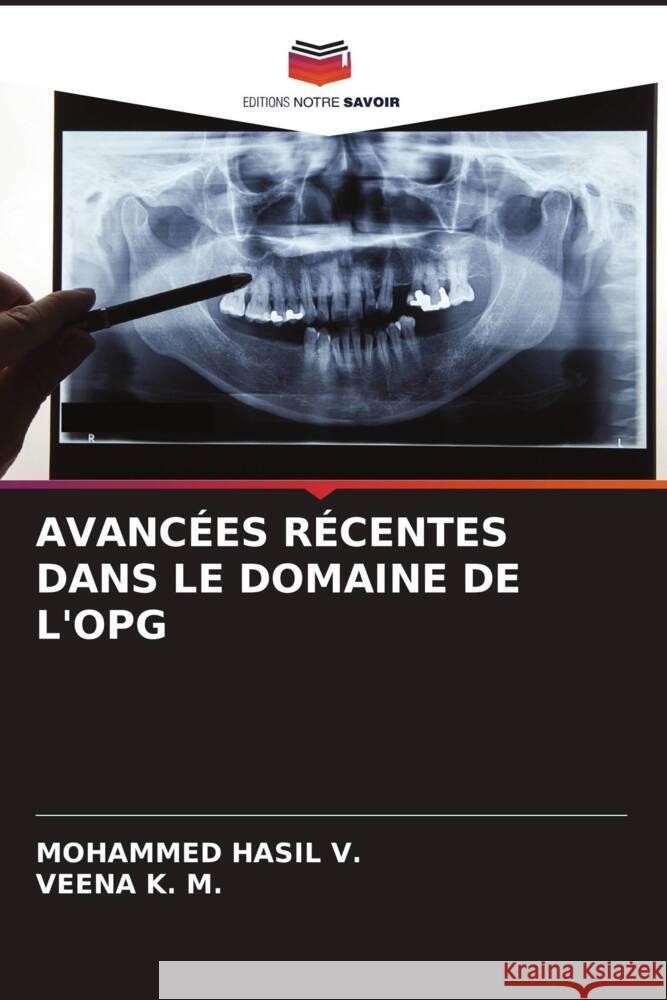 Avanc?es R?centes Dans Le Domaine de l'Opg Mohammed Hasi Veena K 9786206605270 Editions Notre Savoir