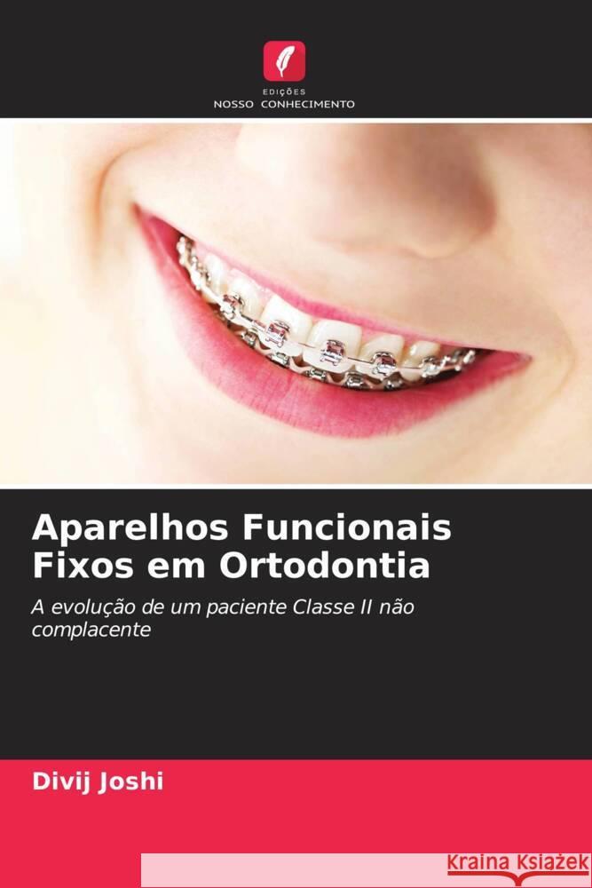 Aparelhos Funcionais Fixos em Ortodontia Divij Joshi 9786206608776