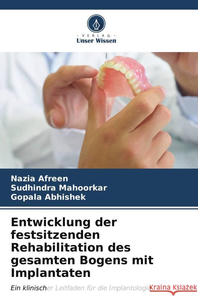 Entwicklung der festsitzenden Rehabilitation des gesamten Bogens mit Implantaten Nazia Afreen Sudhindra Mahoorkar Gopala Abhishek 9786206615439