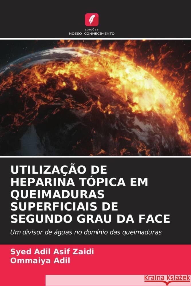 UTILIZAÇÃO DE HEPARINA TÓPICA EM QUEIMADURAS SUPERFICIAIS DE SEGUNDO GRAU DA FACE Asif Zaidi, Syed Adil, Adil, Ommaiya 9786206627111