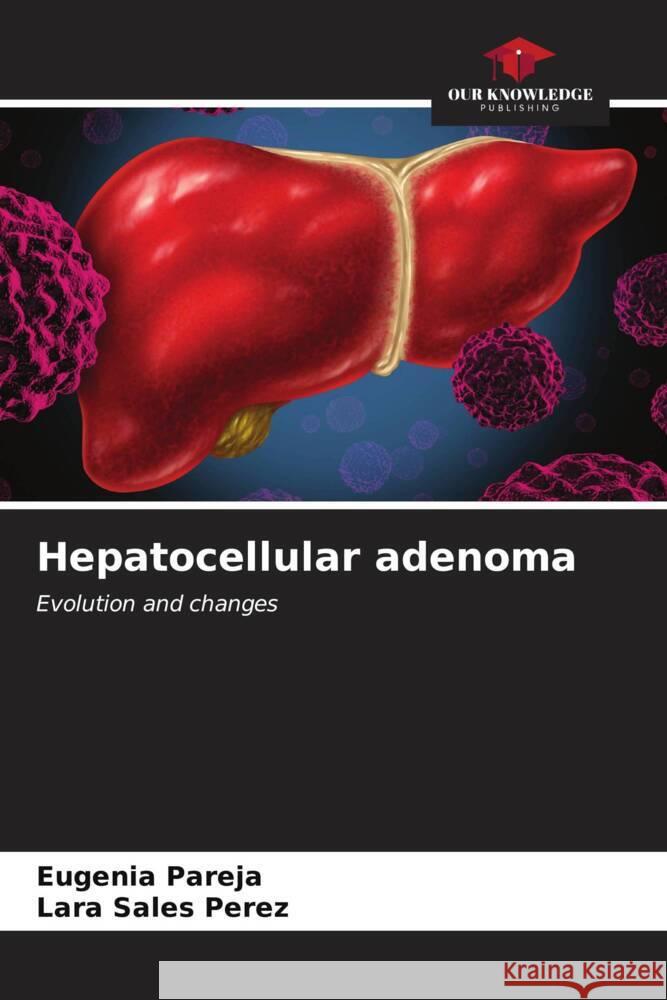 Hepatocellular adenoma Pareja, Eugenia, Sales Perez, Lara 9786206627869