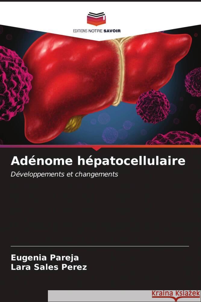 Adénome hépatocellulaire Pareja, Eugenia, Sales Perez, Lara 9786206627876