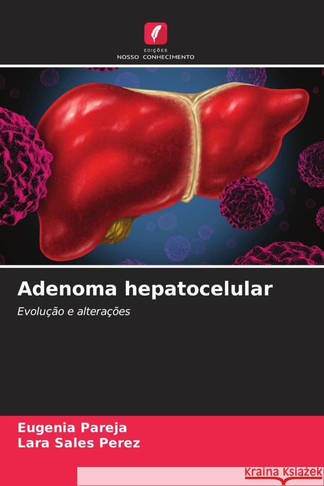 Adenoma hepatocelular Pareja, Eugenia, Sales Perez, Lara 9786206627890