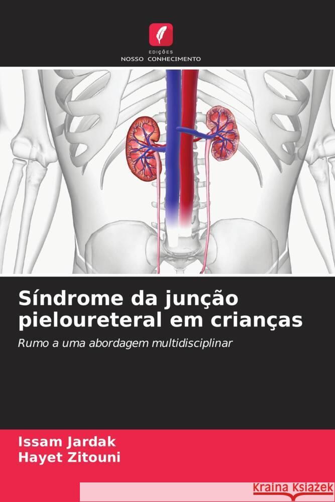 Síndrome da junção pieloureteral em crianças JARDAK, Issam, Zitouni, Hayet 9786206631606