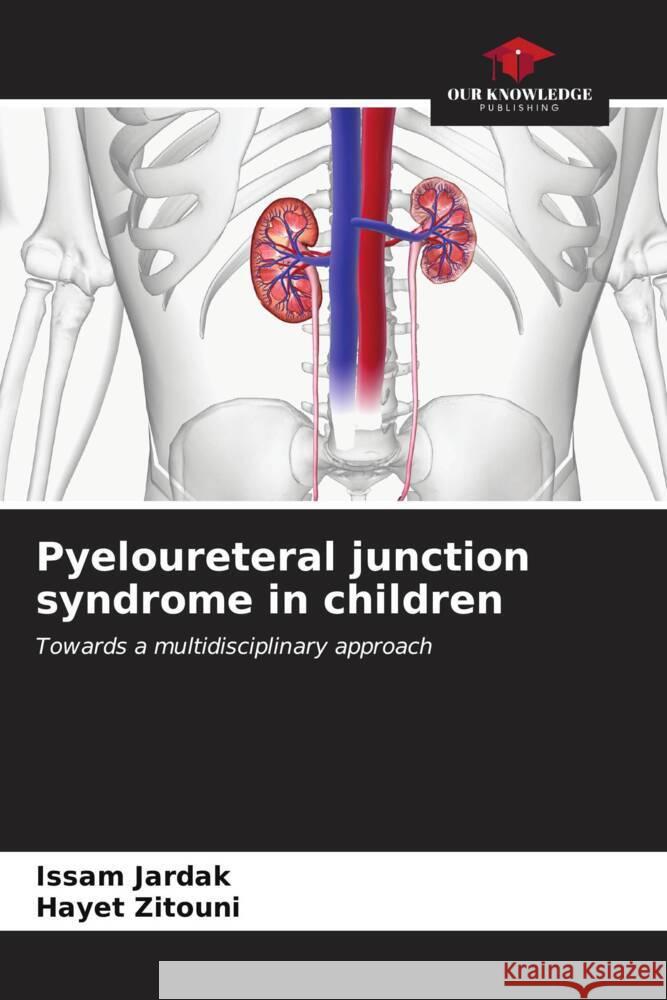 Pyeloureteral junction syndrome in children JARDAK, Issam, Zitouni, Hayet 9786206631712