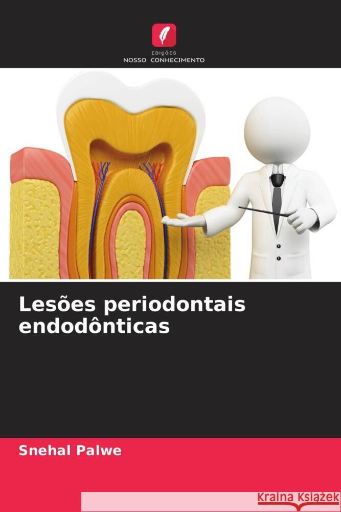 Les?es periodontais endod?nticas Snehal Palwe 9786206643098