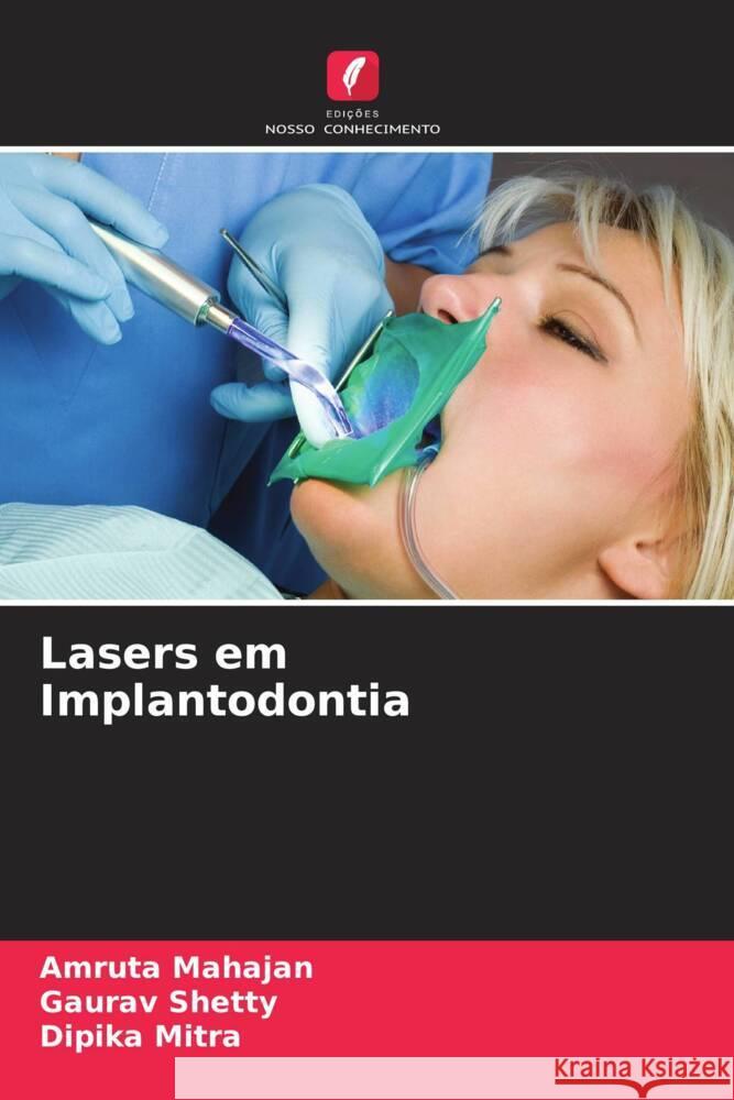 Lasers em Implantodontia Amruta Mahajan Gaurav Shetty Dipika Mitra 9786206643753