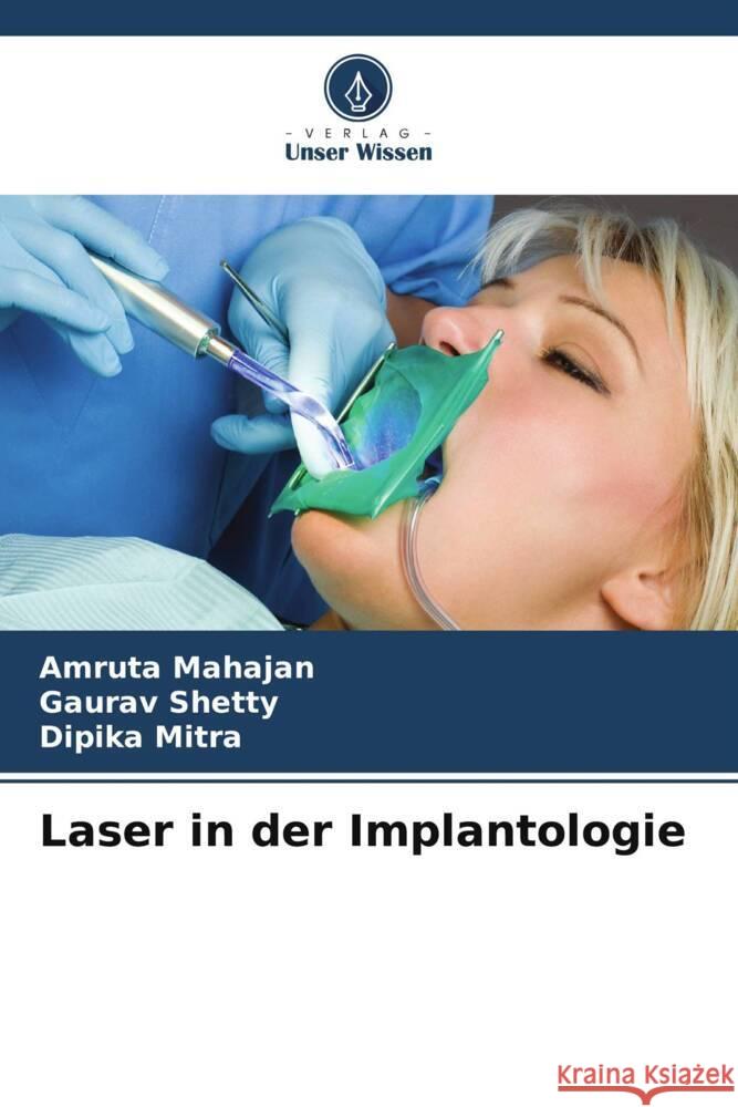 Laser in der Implantologie Amruta Mahajan Gaurav Shetty Dipika Mitra 9786206643760