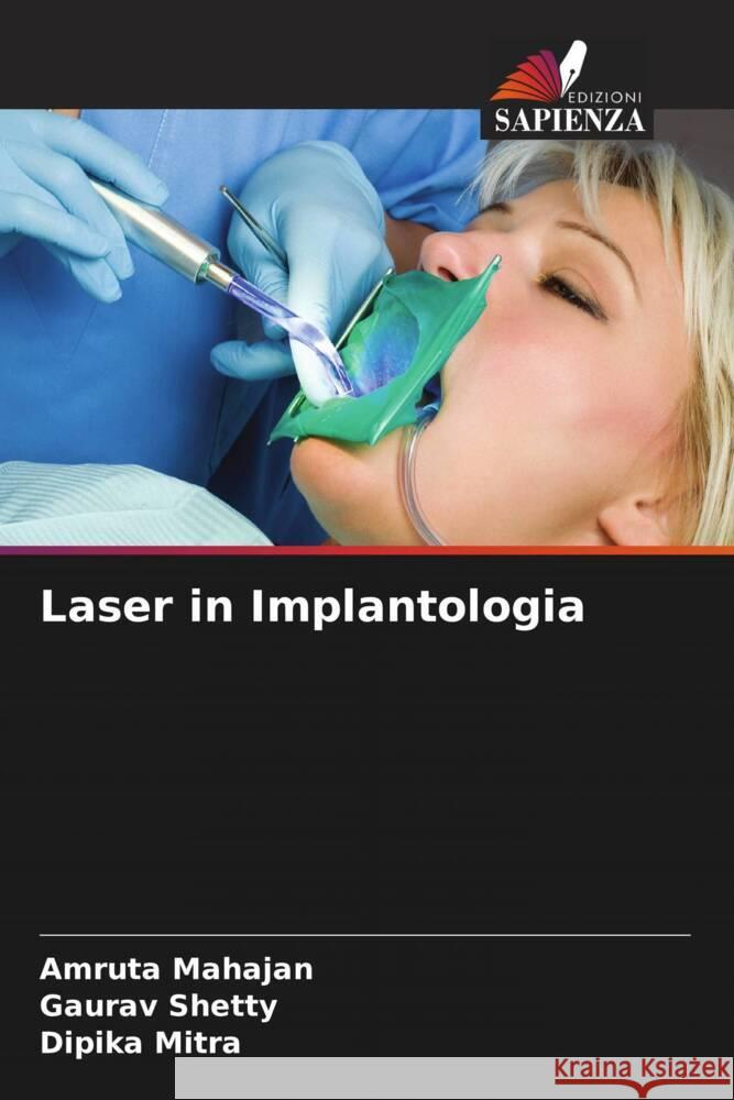 Laser in Implantologia Amruta Mahajan Gaurav Shetty Dipika Mitra 9786206643791