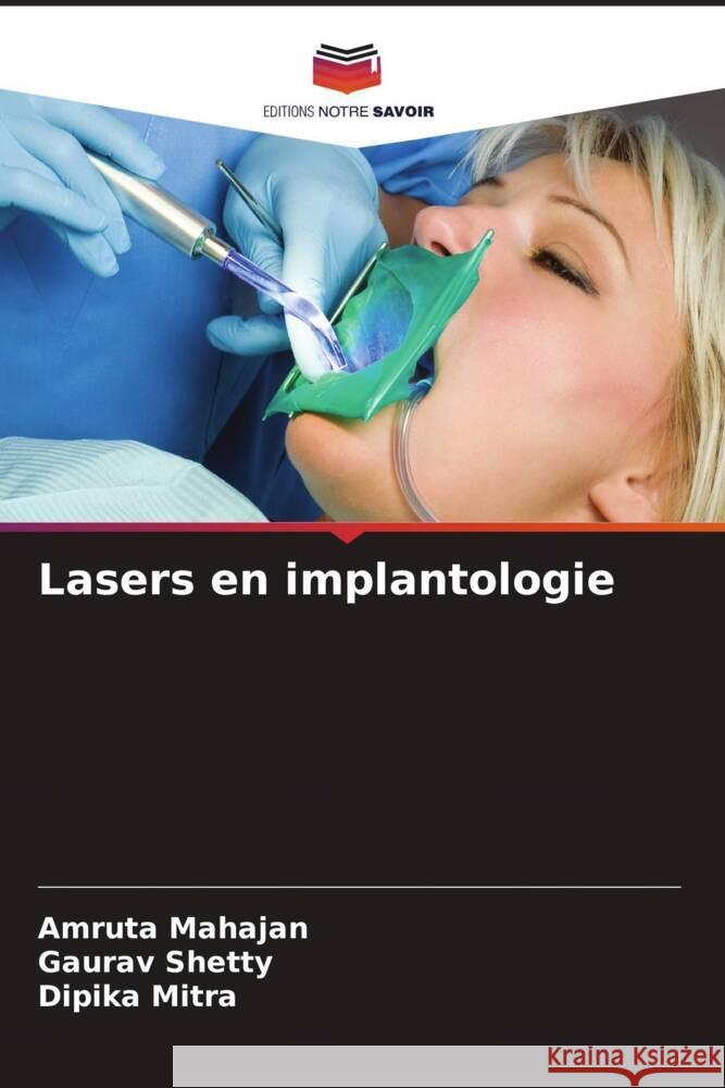 Lasers en implantologie Amruta Mahajan Gaurav Shetty Dipika Mitra 9786206643807