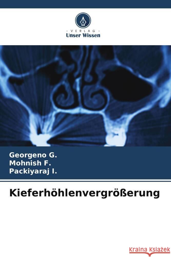 Kieferh?hlenvergr??erung Georgeno G Mohnish F Packiyaraj I 9786206653714