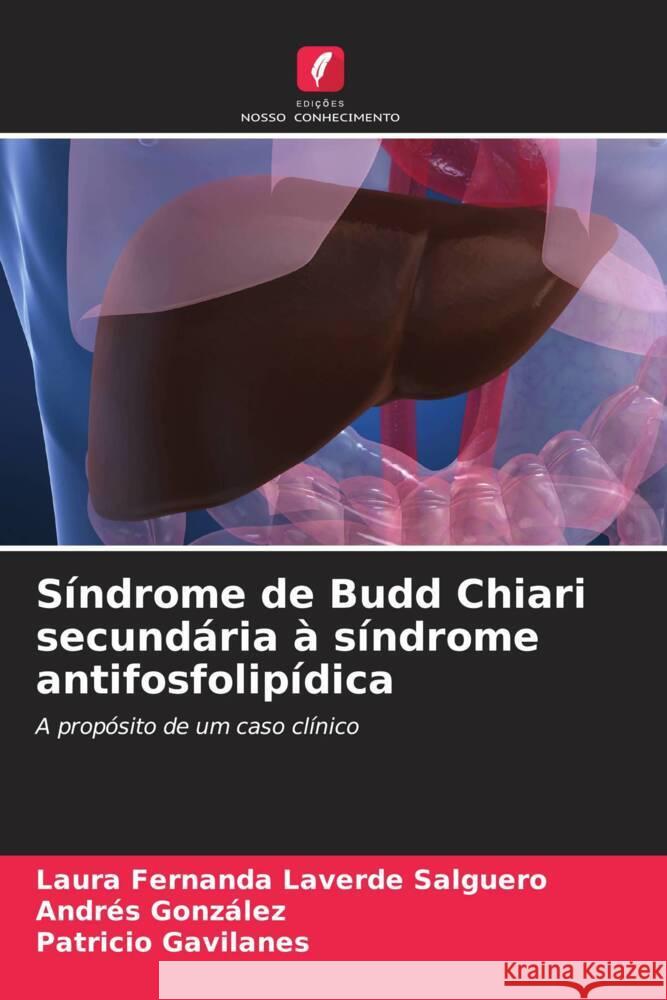 S?ndrome de Budd Chiari secund?ria ? s?ndrome antifosfolip?dica Laura Fernanda Laverd Andres Gonz?lez Patricio Gavilanes 9786206656708