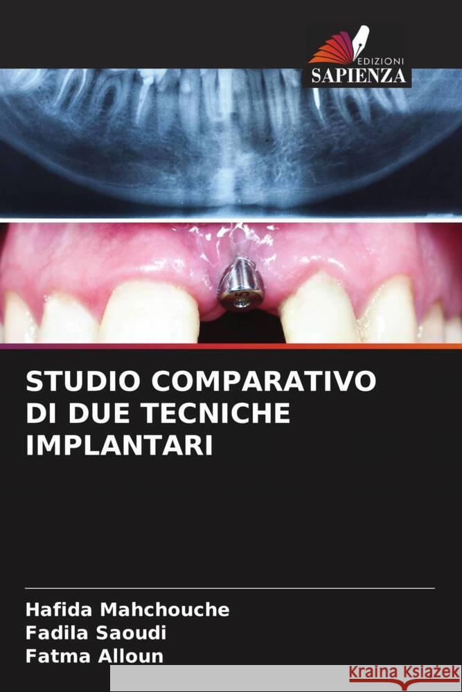 Studio Comparativo Di Due Tecniche Implantari Hafida Mahchouche Fadila Saoudi Fatma Alloun 9786206659648