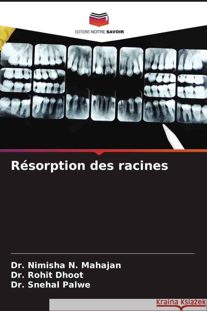 R?sorption des racines Nimisha N. Mahajan Rohit Dhoot Snehal Palwe 9786206669920