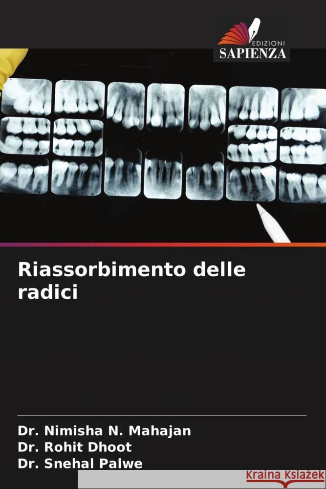 Riassorbimento delle radici Nimisha N. Mahajan Rohit Dhoot Snehal Palwe 9786206669937 Edizioni Sapienza