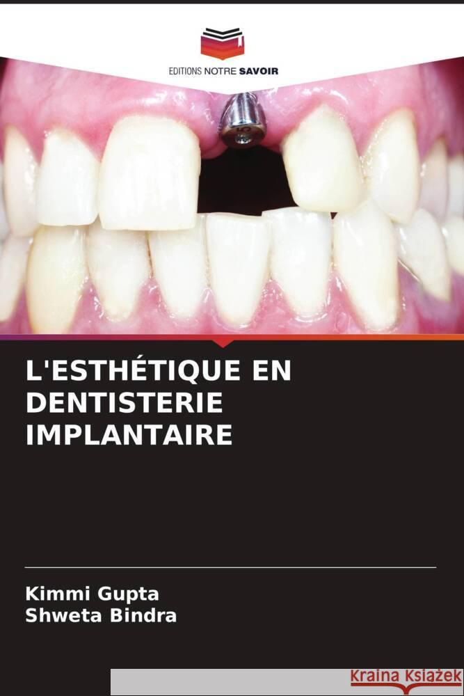 L'Esth?tique En Dentisterie Implantaire Kimmi Gupta Shweta Bindra 9786206670476