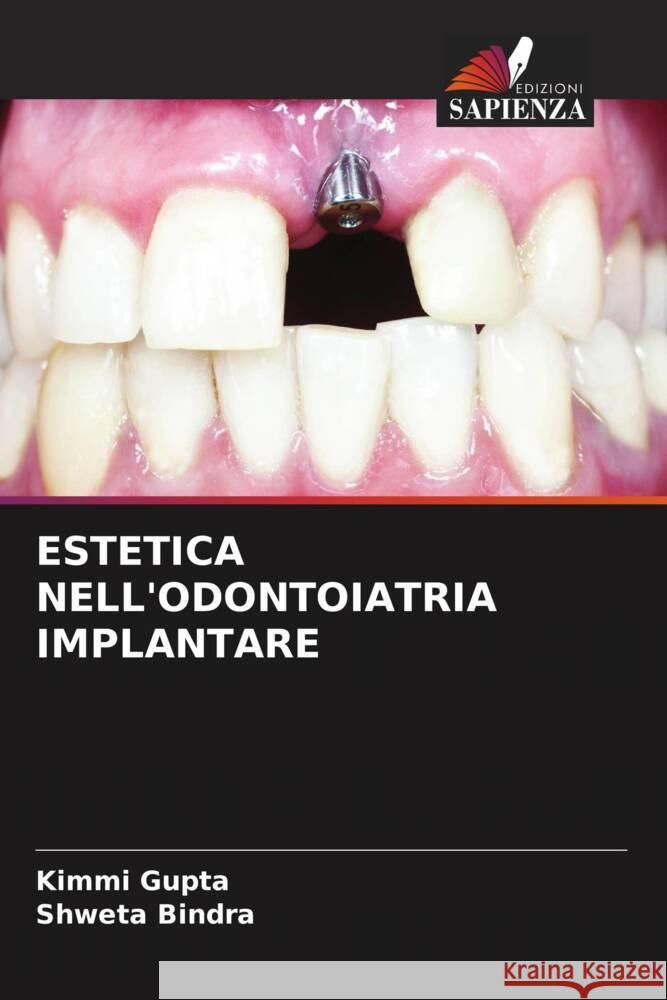 Estetica Nell'odontoiatria Implantare Kimmi Gupta Shweta Bindra 9786206670513