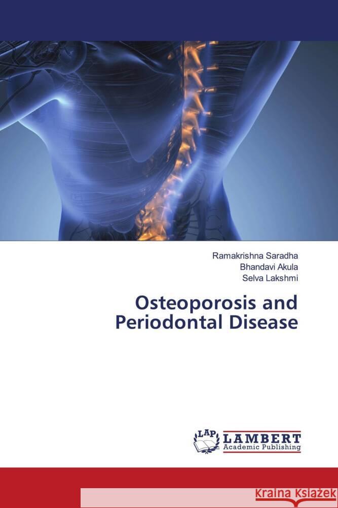 Osteoporosis and Periodontal Disease Saradha, Ramakrishna, Akula, Bhandavi, Lakshmi, Selva 9786206685289