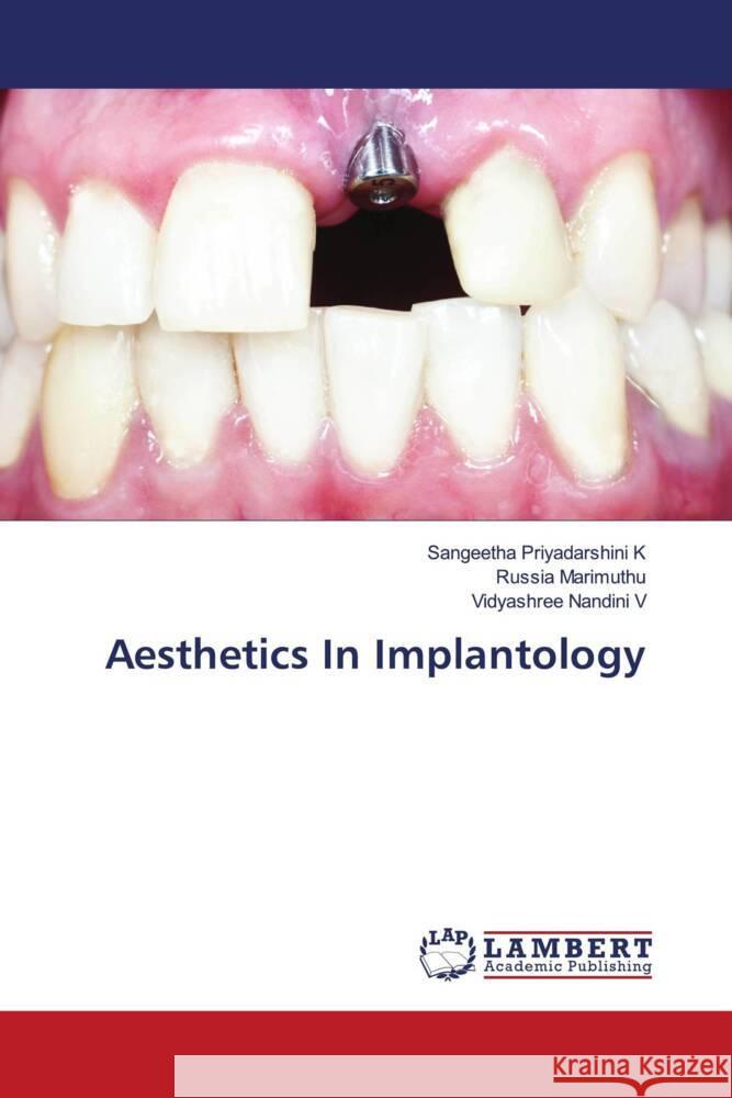 Aesthetics In Implantology K, Sangeetha Priyadarshini, Marimuthu, Russia, V, Vidyashree Nandini 9786206686484 LAP Lambert Academic Publishing