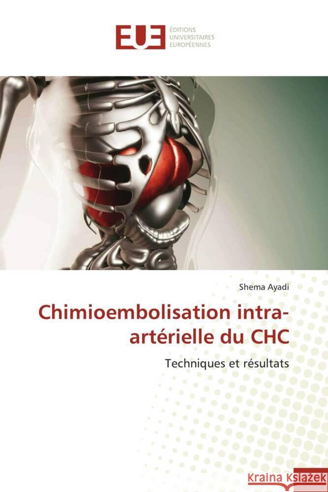 Chimioembolisation intra-artérielle du CHC Ayadi, Shema 9786206689089